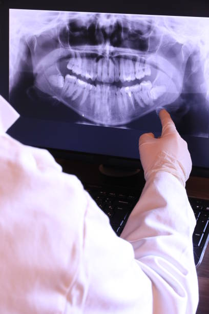 Best Emergency Care for Gum Disease in Canton, GA
